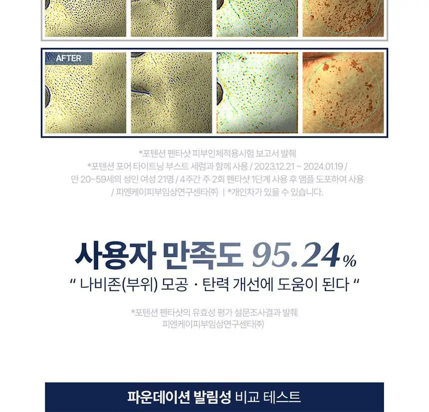 [7중모공케어] 셀로라바이 포텐션 펜타샷 상세페이지 19